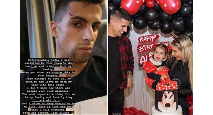 Cancelo chia sẻ vết thương sau vụ cướp tại nhà riêng